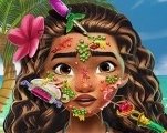 Игра Моана Кожный Доктор